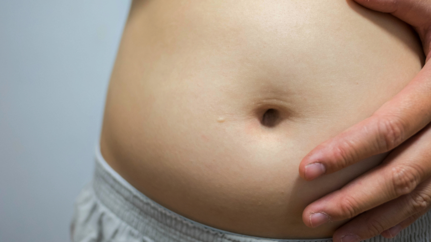 En överviktsoperation är ingen garanti för psykisk hälsa visar studien. Foto: Shutterstock